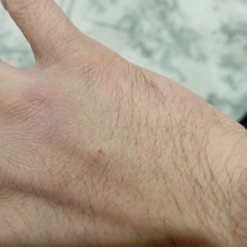 İzmir Bayraklı Şehir Hastanesi Eksiklik Şikayet Görev Yapmama. Yanlış. Bilgilendirme