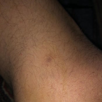 Hobby Isırgan Özlü Şampuan Üretiminden Şikayetçiyim