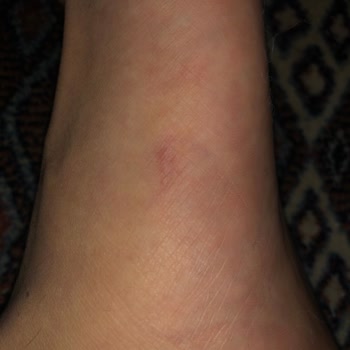 Hobby Isırgan Özlü Şampuan Üretiminden Şikayetçiyim