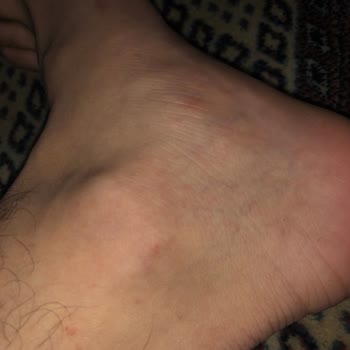 Hobby Isırgan Özlü Şampuan Üretiminden Şikayetçiyim