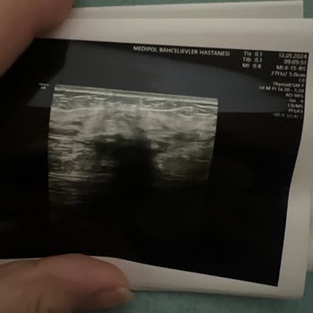 Medipol Sağlık Grubu Para İçin Gereksiz İşlemlerine Çalışanları Da Şaşırdı