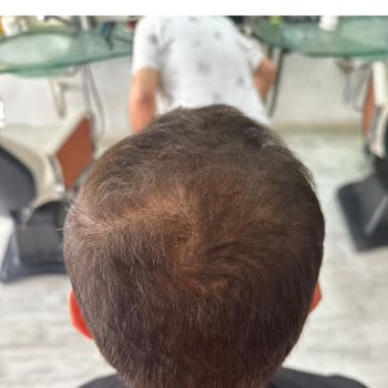 Eki aç