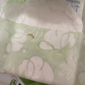 Kotex Ped Paketinde Karşılaşılan Uygunsuz Durum