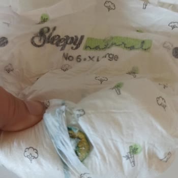 Sleepy Yabancı Cisim Çıktı