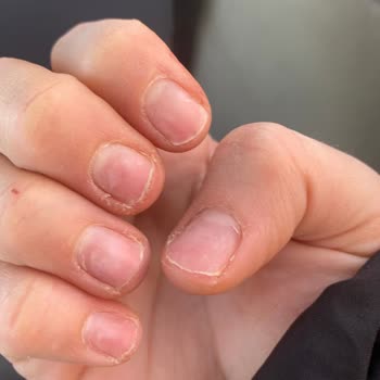 Zehra Görgen Beauty Tırnaklarımı Mahvettiler