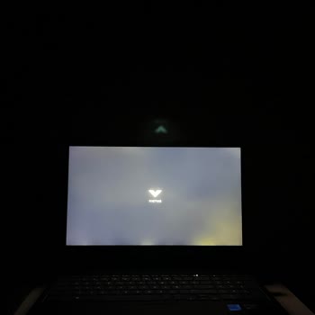 HP Victus Kronik Işık Sızması Ve Ölü Piksel İle Geldi