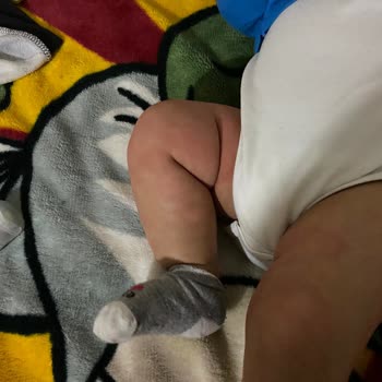 Organik Olduğunu İddia Eden Hipp'in Bebeğimde Sebep Olduğu Ürtiker!