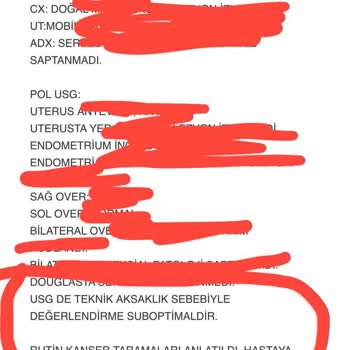 Düzce Atatürk Devlet Hastanesi Doktorlar Profesyonel Değil