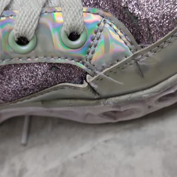 Skechers Marka Mağduriyetimizi Gidermiyor