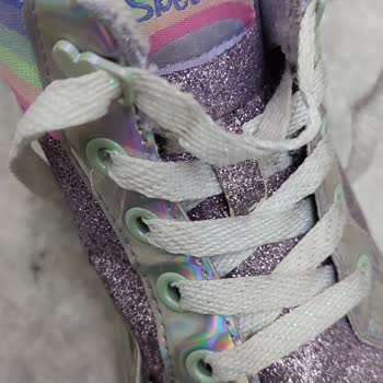 Skechers Marka Mağduriyetimizi Gidermiyor