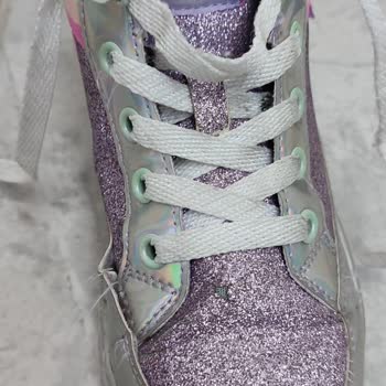 Skechers Marka Mağduriyetimizi Gidermiyor