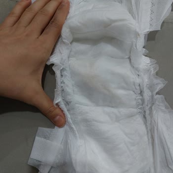 Baby Turco Bebek Bezi Kullanımında Karşılaşılan Yabancı Madde Sorunu