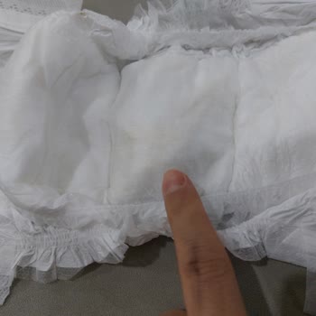 Baby Turco Bebek Bezi Kullanımında Karşılaşılan Yabancı Madde Sorunu