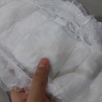 Baby Turco Bebek Bezi Kullanımında Karşılaşılan Yabancı Madde Sorunu