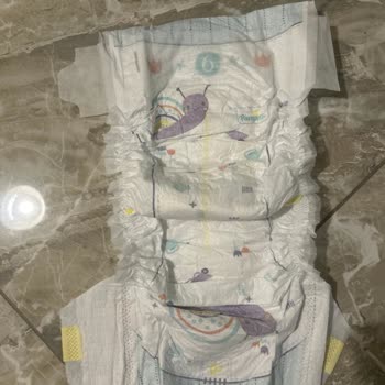 ebebek E Bebekten Alığım Prima Premium Care Kusurlu Ürün Çıktı
