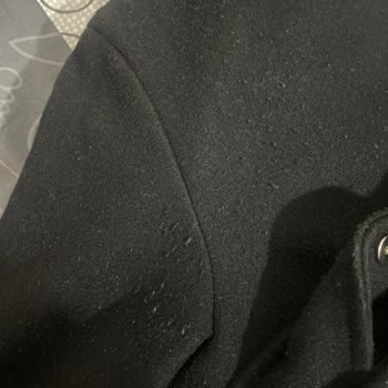 Bershka Şikayet Var Tüylenme