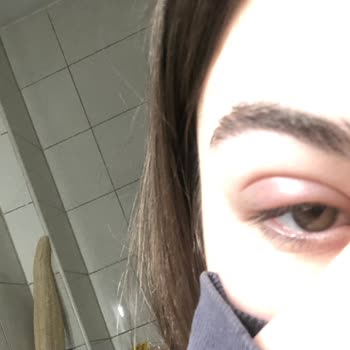 Maruderm Yüz Yıkama Jeli!