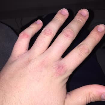 EasyCep Telefonum Yandı Ve Kullanılmaz Halde!