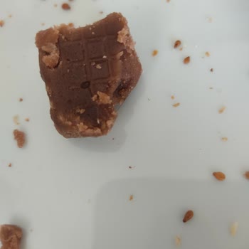 Koska Nazar Boncuklu Koska Helvadan Saç Kılı Çıktı