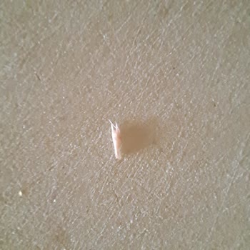 Aytaç Salamın İçinde Sert Ve Tüy Gibi Şeylerin Bulunması