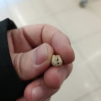 Maksul Kuruyemiş Kurtlu Nohut Hayal Kırıklığı