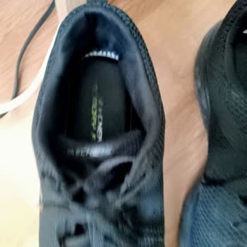Skechers Ayakkabı Taban Problemi