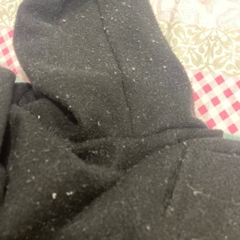Bershka Kabanın Aşırı Tüylenmesi