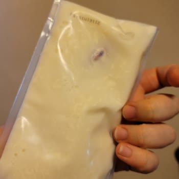 Başkent Üniversitesi Ankara Hastanesi Oğlumun Yattığı Sürede Yaşadığım Sorunlar