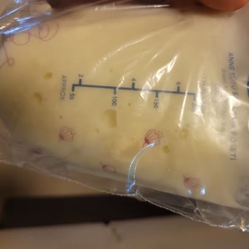 Başkent Üniversitesi Ankara Hastanesi Oğlumun Yattığı Sürede Yaşadığım Sorunlar