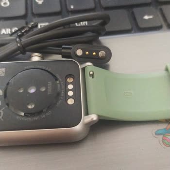 Vestel Akıllı Saatin Kısa Sürede Paslanması Ve Müşteri Hizmetleri Süreci