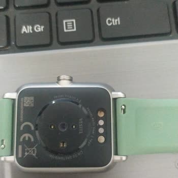 Vestel Akıllı Saatin Kısa Sürede Paslanması Ve Müşteri Hizmetleri Süreci