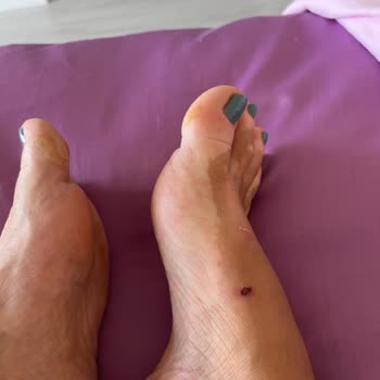 Derimod Mağazası Yara Yapan Terliği Görmezden Geldi