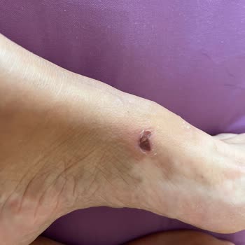 Derimod Mağazası Yara Yapan Terliği Görmezden Geldi