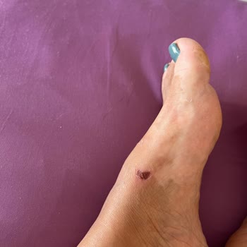 Derimod Mağazası Yara Yapan Terliği Görmezden Geldi