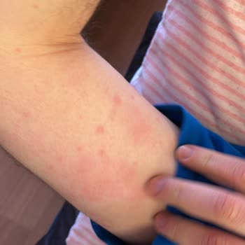 Atabay İlaç Firması Qsmok 150 Mg Tablet