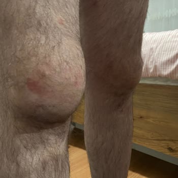 Atabay İlaç Firması Qsmok 150 Mg Tablet