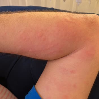 Atabay İlaç Firması Qsmok 150 Mg Tablet