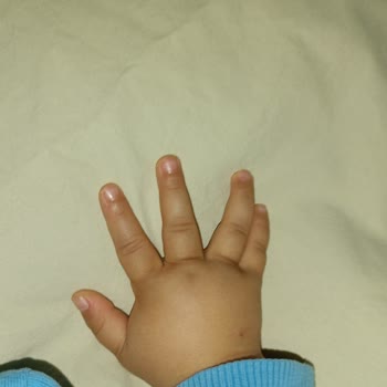 Markasi Hospital Özel Markasi Acil Müdahale Şikayet