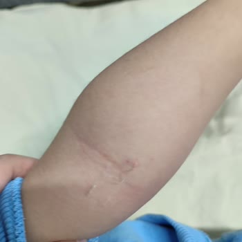 Markasi Hospital Özel Markasi Acil Müdahale Şikayet