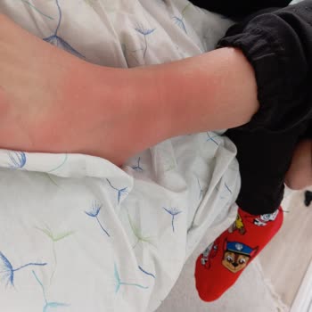 Atabay İlaç Firması Enfluvir İlacının Yan Etkileriyle Mücadele