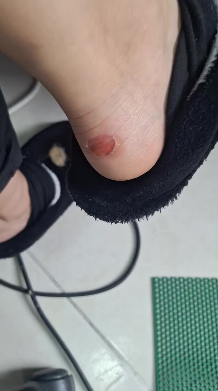 Bershka Boot Caused Blisters on My Heels video cover