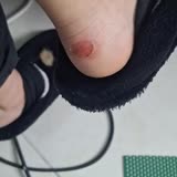 Bershka Boot Caused Blisters on My Heels