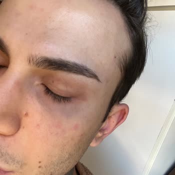 Bioderma Sensibio Yüz Temizleme Jeli