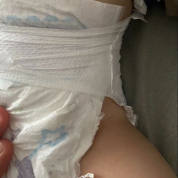 Molfix Bebek Bezi Müşteri Memnuniyeti