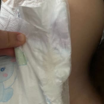 Molfix Bebek Bezi Müşteri Memnuniyeti