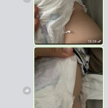 Molfix Bebek Bezi Müşteri Memnuniyeti