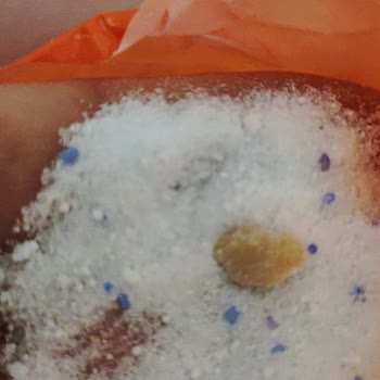 Alo Epttavm, Liberty Ve Alo Şikayetçiyim Deterjan Yerine Tuz Gönderdiler.