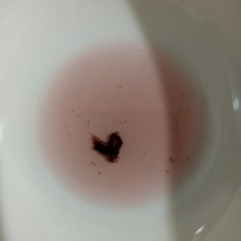 Link İçecek Link İçeceği İçinden Çıkan