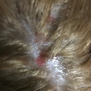 Palette İnsanların Saç Derilerini Yakıyor!