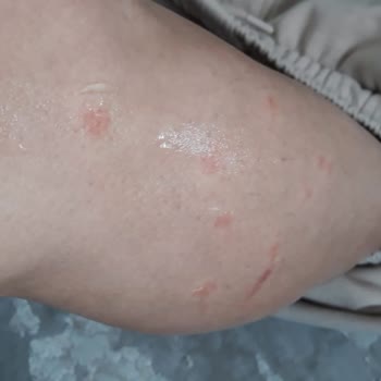 Umut Thermal'den Şikayetim Var